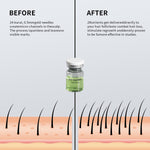 Bodyvise Jojoba Microneedle Regrowth Serum